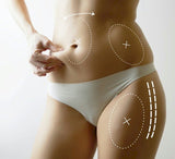 Coolsculpting