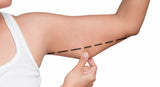 Coolsculpting