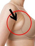 Coolsculpting