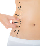 Coolsculpting