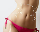 Coolsculpting