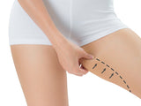 Coolsculpting