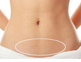 Coolsculpting