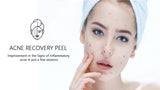 Acne Recovery Peel
