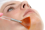 Glycolic Acid Peel