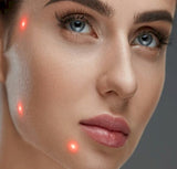 StarWalker Hybrid Laser - Skin Whitening