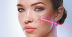 StarWalker Hybrid Laser - Skin Whitening